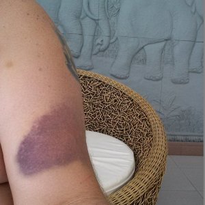 Battle Scars