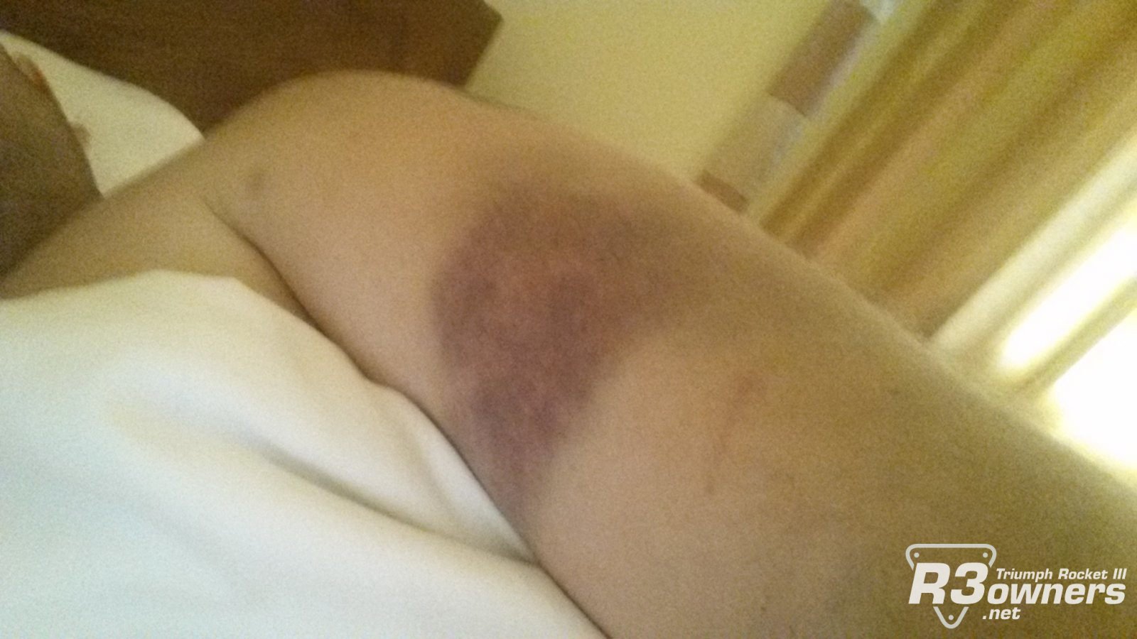 A little battle scar