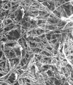 microscopic view of oil filter