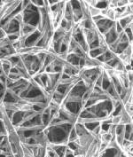 microscopic view of oil filter